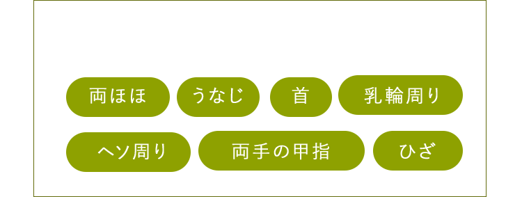 Sパーツ